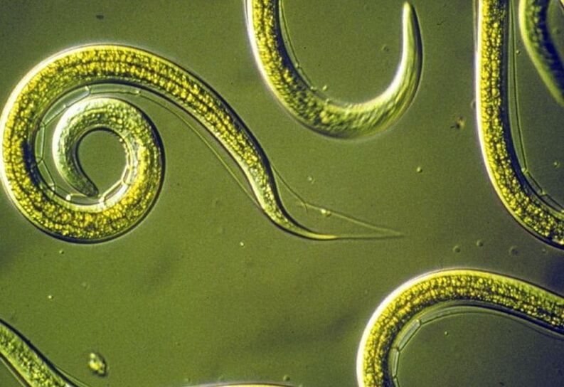 roundworms from the human body