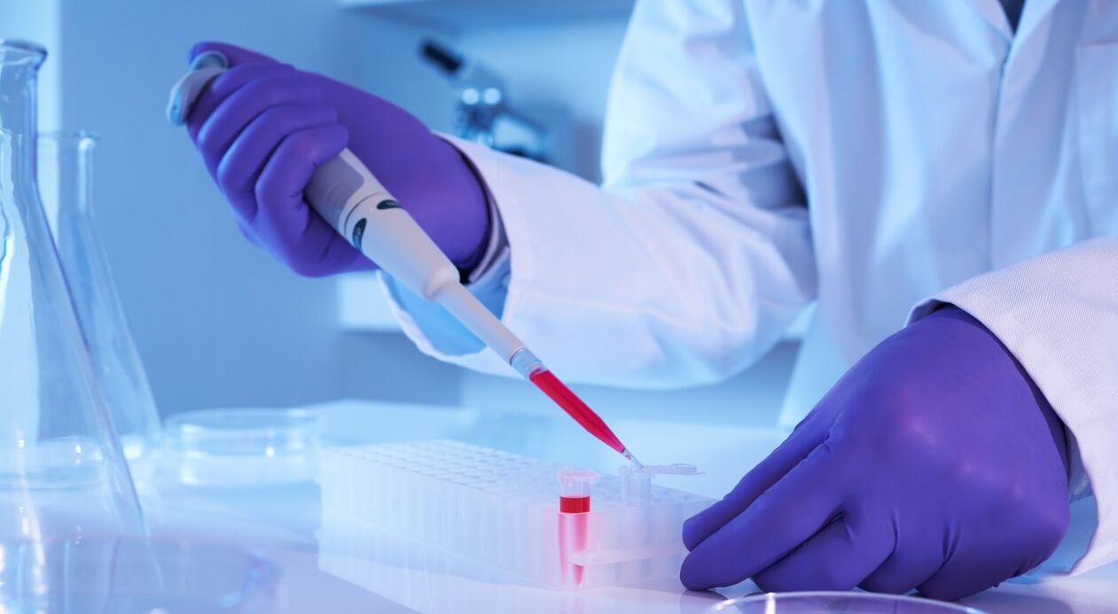 How to carry out a parasit analysis