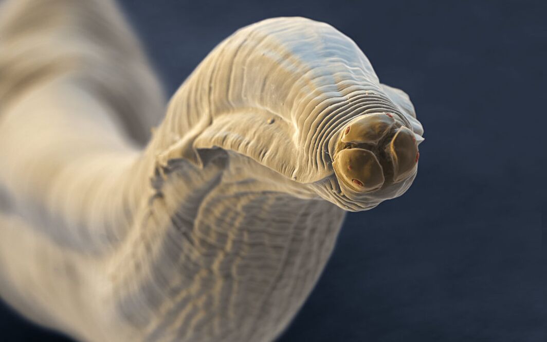 Toxocara from the human body