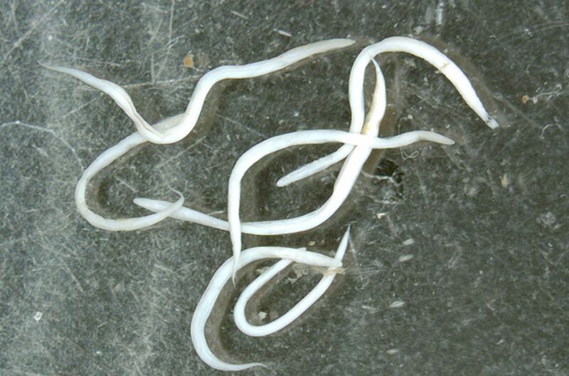 Worm parasite from the human body