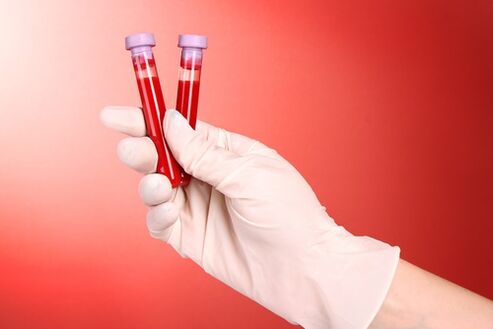 Blood test for parasites