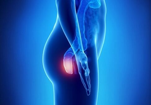 Itching in the rectum as an indication for a parasite test