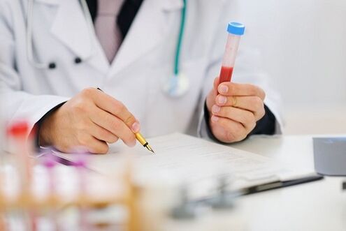 Tests for parasites