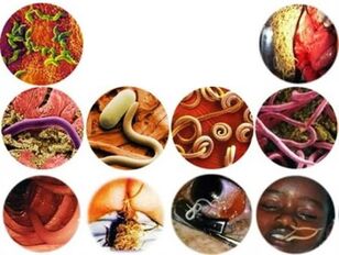 How to remove parasites from the body using folk remedies