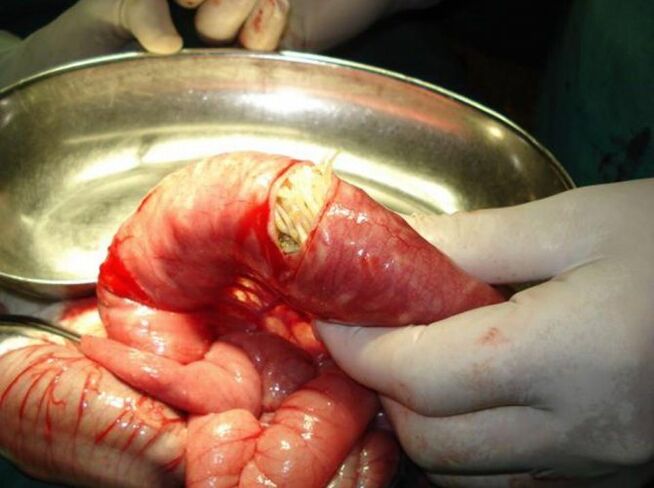 These parasites are dangerous for humans
